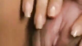 A close-up view of a big hairy clitoris and wet pussy lips